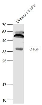 CTGF Rabbit Polyclonal Antibody