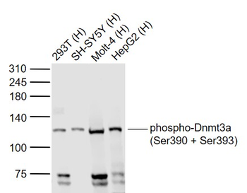 Phospho-Dnmt3a (Ser390 + Ser393) Rabbit Polyclonal Antibody
