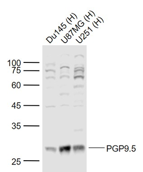PGP9.5 Rabbit Polyclonal Antibody
