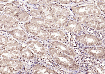 LSM6 Rabbit Polyclonal Antibody