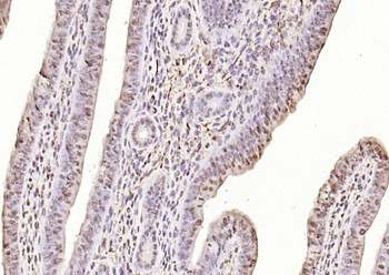 LSM6 Rabbit Polyclonal Antibody