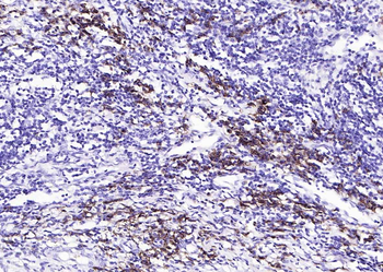 CD38 Recombinant Rabbit Monoclonal Antibody