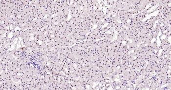 Phospho-JNK1/2/3 (T183+T183+T221) Recombinant Rabbit Monoclonal Antibody