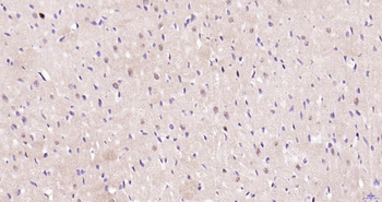Phospho-JNK1/2/3 (T183+T183+T221) Recombinant Rabbit Monoclonal Antibody