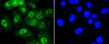 Phospho-JNK1/2/3 (T183+T183+T221) Recombinant Rabbit Monoclonal Antibody