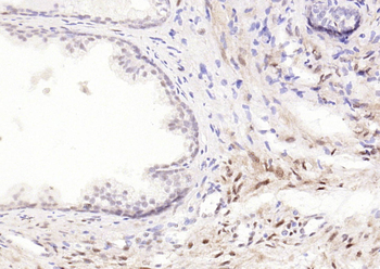 Phospho-JNK1/2/3 (T183+T183+T221) Recombinant Rabbit Monoclonal Antibody