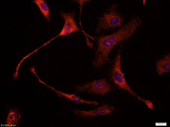 CK18 Mouse Monoclonal Antibody