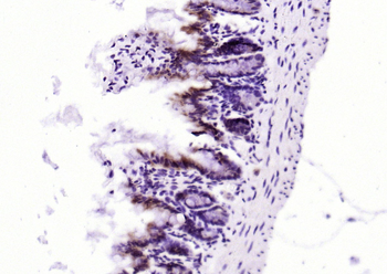 SLC15A1 Rabbit Polyclonal Antibody