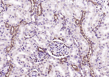 SLC15A1 Rabbit Polyclonal Antibody