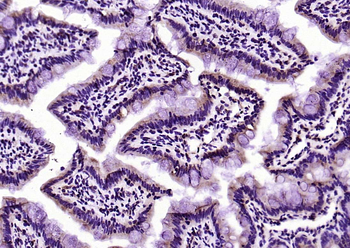 SLC15A1 Rabbit Polyclonal Antibody