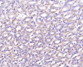 Integrin alpha 2 Recombinant Rabbit Monoclonal Antibody