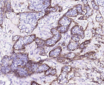Integrin alpha 2 Recombinant Rabbit Monoclonal Antibody