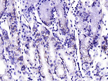 Integrin alpha 2 Recombinant Rabbit Monoclonal Antibody