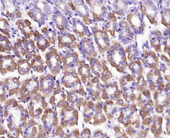 Integrin alpha 2 Recombinant Rabbit Monoclonal Antibody