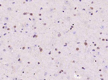 ERK1/2 Recombinant Rabbit Monoclonal Antibody