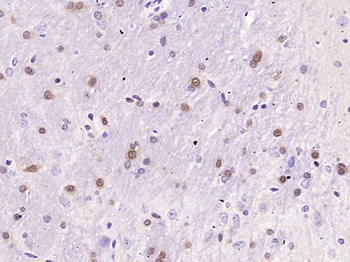 ERK1/2 Recombinant Rabbit Monoclonal Antibody
