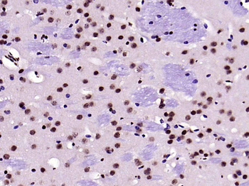 HMGB1 Rabbit Polyclonal Antibody