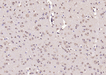UBE2Q1 Rabbit Polyclonal Antibody