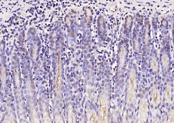 UBE2Q1 Rabbit Polyclonal Antibody