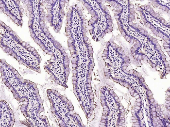 ACE2 Rabbit Polyclonal Antibody