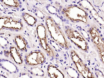 ACE2 Rabbit Polyclonal Antibody