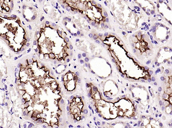 ACE2 Rabbit Polyclonal Antibody