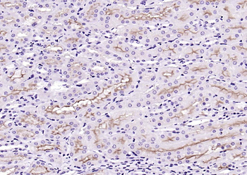 ACE2 Rabbit Polyclonal Antibody
