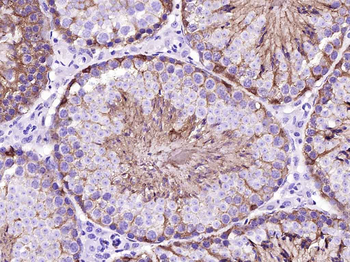 GAPDH Recombinant Rabbit Monoclonal Antibody (Loading Control)