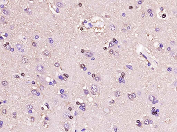 GAPDH Recombinant Rabbit Monoclonal Antibody (Loading Control)