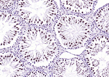 Ubiquitin Mouse Monoclonal Antibody