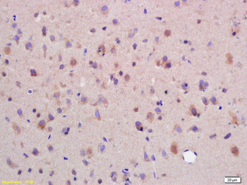 SYTL5 Rabbit Polyclonal Antibody