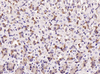 TAK1 Rabbit Polyclonal Antibody