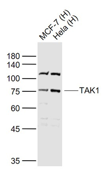 TAK1 Rabbit Polyclonal Antibody