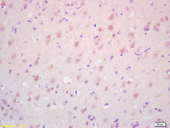 TAK1 Rabbit Polyclonal Antibody