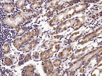 Phospho-TAK1 (Thr187) Rabbit Polyclonal Antibody
