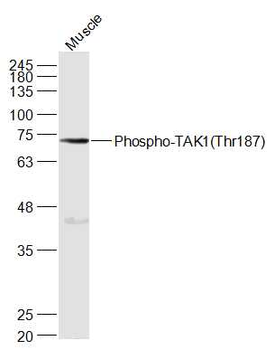 Phospho-TAK1 (Thr187) Rabbit Polyclonal Antibody