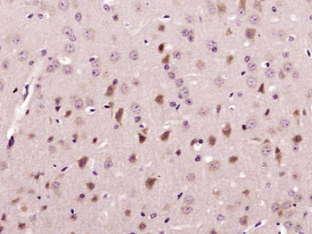 Talin Rabbit Polyclonal Antibody
