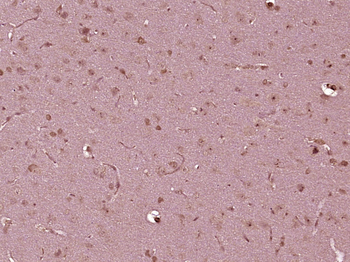 TFEB Rabbit Polyclonal Antibody