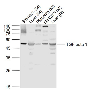 TGF beta 1 Rabbit Polyclonal Antibody