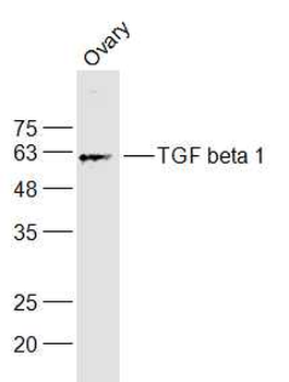 TGF beta 1 Rabbit Polyclonal Antibody