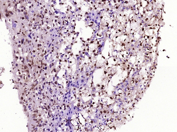 TNFAIP3 Rabbit Polyclonal Antibody