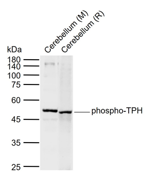 Phospho-TPH (Ser260) Rabbit Polyclonal Antibody