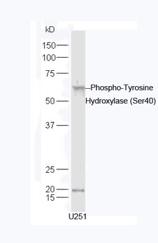 Phospho-Tyrosine Hydroxylase (Ser40) Rabbit Polyclonal Antibody