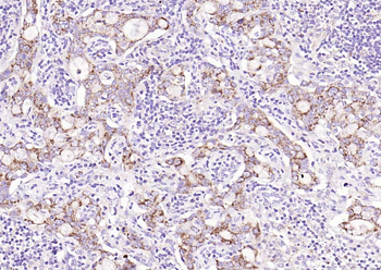 APG4B (Acetyl K39) Rabbit Polyclonal Antibody