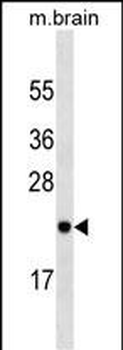 RAB23 Mouse Monoclonal Antibody
