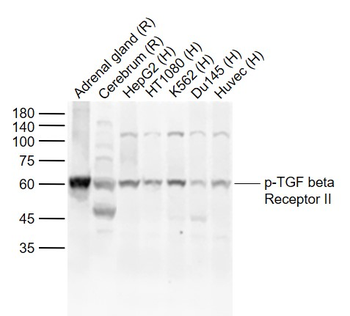 Phospho-TGF beta Receptor II (Ser225) Rabbit Polyclonal Antibody