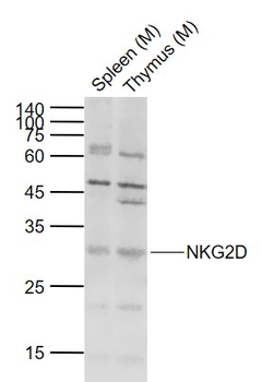 NKG2D Rabbit Polyclonal Antibody