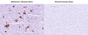 Beta-Amyloid (1-42) Mouse Monoclonal Antibody