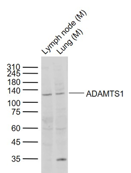 ADAMTS1 Rabbit Polyclonal Antibody