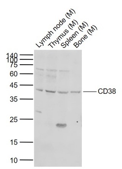 CD38 Rabbit Polyclonal Antibody